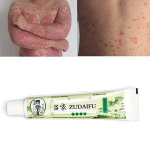 Dropshipping Zudaifu Skin Psoriasis Cream Dermatitis Eczematoid Eczema Ointment Treatment Psoriasis Cream Skin Care Cream